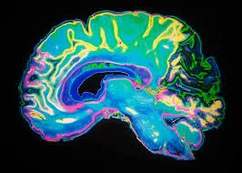 How Pornography Affects Your Brain [is porn good for you?]